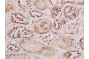Formalin-fixed and paraffin embedded mouse kidney labeled with Rabbit Anti-CD13/APN/ANPEN Polyclonal Antibody, Unconjugated  at 1:200 followed by conjugation to the secondary antibody and DAB staining (CD13 antibody  (AA 344-444))