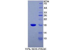 SDS-PAGE (SDS) image for Somatostatin (SST) (AA 1-116) protein (His tag) (ABIN1099469) (Somatostatin Protein (SST) (AA 1-116) (His tag))