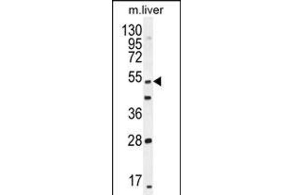 THEMIS antibody  (C-Term)