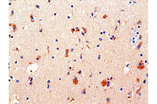 GABA antibody