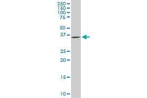 Western Blotting (WB) image for anti-Decapping Enzyme, Scavenger (DCPS) (AA 1-338) antibody (ABIN466201) (DCPS antibody  (AA 1-338))