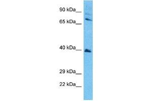 Host:  Rabbit  Target Name:  SETD7  Sample Type:  Jurkat Whole Cell lysates  Antibody Dilution:  1. (SETD7 antibody  (N-Term))