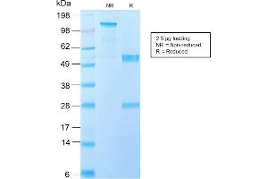 SDS-PAGE Analysis Purified IL-10 Recombinant Rabbit Monoclonal Antibody (IL10/2651R). (Recombinant IL-10 antibody)