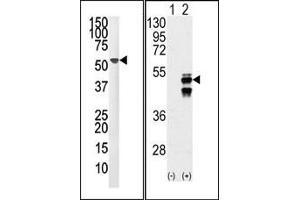 Image no. 1 for anti-Protein Phosphatase 1F (PP2C Domain Containing) (PPM1F) (N-Term) antibody (ABIN360800) (PPM1F antibody  (N-Term))