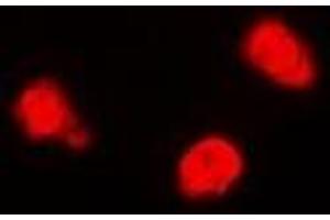 Immunofluorescent analysis of TIP60 staining in Jurkat cells. (KAT5 antibody)