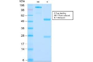 SDS-PAGE Analysis Purified MUC3 Rabbit Recombinant Monoclonal Antibody (MUC3/2992R). (Recombinant MUC3A antibody)