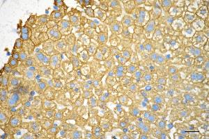 Immunohistochemistry was performed on paraffin-embedded mouse liver using keratin 18 antibody (ABIN7799174), 1:200).