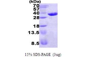 Enoyl CoA Hydratase Domain Containing 1 (ECHDC1) (AA 1-307) protein (His tag)