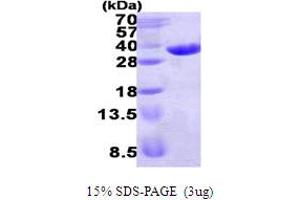 SDS-PAGE (SDS) image for Enoyl CoA Hydratase Domain Containing 1 (ECHDC1) (AA 1-307) protein (His tag) (ABIN667683) (ECHDC1 Protein (AA 1-307) (His tag))