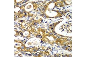 Immunohistochemistry (Paraffin-embedded Sections) (IHC (p)) image for anti-Mitochondrial Import Receptor Subunit TOM20 homolog (TOMM20) (AA 20-145) antibody (ABIN6149382)