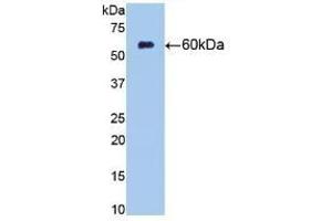 Detection of Recombinant NT5E, Rat using Monoclonal Antibody to Cluster Of Differentiation 73 (CD73) (CD73 antibody  (AA 29-550))