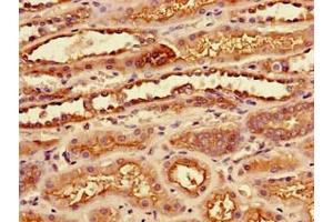 Immunohistochemistry of paraffin-embedded human kidney tissue using ABIN7175933 at dilution of 1:100 (SLC7A7 antibody  (AA 325-382))