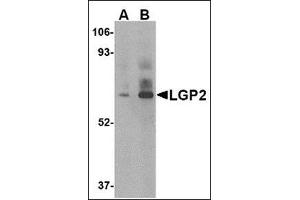 Western blot analysis of LGP2 in rat kidney tissue lysate with this product at (A) 1 and (B) 2 μg/ml. (DHX58 antibody  (C-Term))