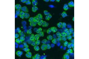 Staining of a cytospin preparation of peripheral blood mononuclear cells isolated from buffycoat. (Cathelicidin antibody)