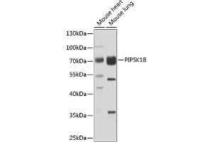 Western blot analysis of extracts of various cell lines, using PIP5K1B antibody (ABIN6130645, ABIN6145684, ABIN6145686 and ABIN6223693) at 1:1000 dilution.