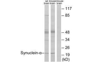 Western blot analysis of extracts from rat brain and mouse brain, using Synuclein-α (Ab-125) antibody. (SNCA antibody  (Tyr125))