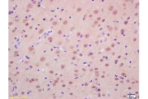 Formalin-fixed and paraffin embedded rat brain labeled with Anti-RASSF2 Polyclonal Antibody, Unconjugated (ABIN681988) at 1:200 followed by conjugation to the secondary antibody and DAB staining. (RASSF2 antibody  (AA 201-300))
