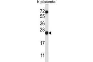 Western Blotting (WB) image for anti-Ribonuclease, RNase A Family, 8 (RNASE8) antibody (ABIN2997335)