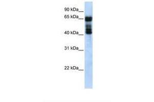 Image no. 1 for anti-UDP Glucuronosyltransferase 2 Family, Polypeptide B4 (UGT2B4) (AA 38-87) antibody (ABIN6738586) (UGT2B4 antibody  (AA 38-87))