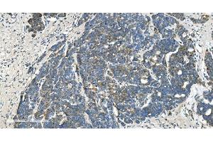 IHC analysis of TIMM8A/DDP using anti-TIMM8A/DDP antibody (ABIN7600039).