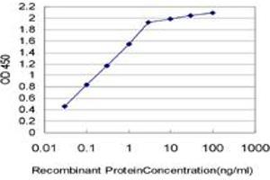 Detection limit for recombinant GST tagged ESM1 is approximately 0. (ESM1 antibody  (AA 85-184))