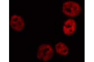 ABIN6267689 staining HT29 by IF/ICC. (FANCD2 antibody  (pSer222))