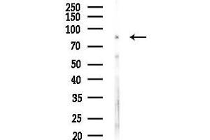 anti-Matrix Metallopeptidase 15 (Membrane-inserted) (MMP15) (C-Term) antibody