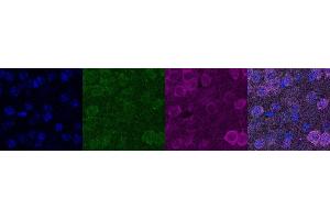 Immunohistochemistry (IHC) image for anti-Cellular Retinoic Acid Binding Protein 1 (CRABP1) antibody (ABIN7456170) (CRABP1 antibody)