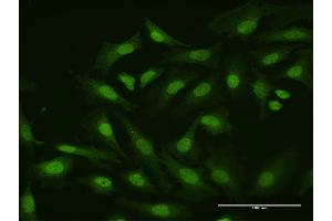 Immunofluorescence of purified MaxPab antibody to HHEX on HeLa cell. (HHEX antibody  (AA 1-270))