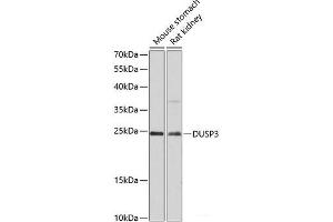 Western blot analysis of extracts of various cell lines using DUSP3 Polyclonal Antibody at dilution of 1:3000. (Dual Specificity Phosphatase 3 (DUSP3) antibody)