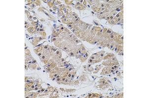 Immunohistochemistry of paraffin-embedded human stomach using TRMT2A antibody (ABIN5973559) at dilution of 1/100 (40x lens). (TRMT2A antibody)