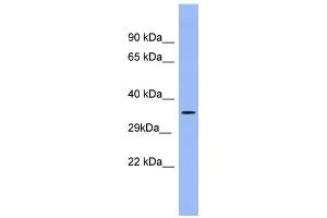 WB Suggested Anti-PSG5 Antibody Titration:  0. (PSG5 antibody  (Middle Region))
