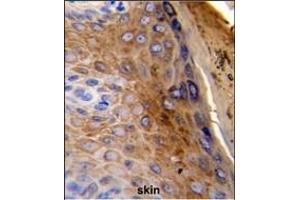 Formalin-fixed and paraffin-embedded human skin reacted with KRT10 Antibody (Center), which was peroxidase-conjugated to the secondary antibody, followed by DAB staining. (Keratin 10 antibody  (AA 318-346))