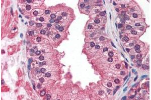 Prostate: Formalin-Fixed, Paraffin-Embedded (FFPE) (IGF1R antibody)