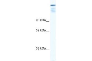 Western Blotting (WB) image for anti-Zinc Finger Protein 106 Homolog (ZFP106) antibody (ABIN2460682) (ZFP106 antibody)