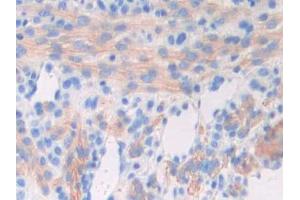 IHC-P analysis of Mouse Uterus Tissue, with DAB staining. (GAD antibody  (AA 1-97))