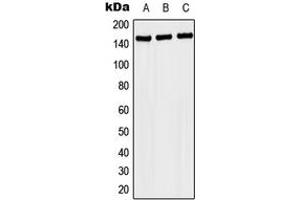 Western blot analysis of NACAD expression in MCF7 (A), SP2/0 (B), H9C2 (C) whole cell lysates.