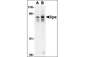 Western blot analysis of lipe in human lymph node tissue lysate with this product at (A) 0.