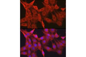 Immunofluorescence analysis of PC-12 cells using Galectin 1/LG Rabbit pAb (ABIN6130424, ABIN6143156, ABIN6143157 and ABIN6218649) at dilution of 1:50 (40x lens). (LGALS1/Galectin 1 antibody  (AA 1-135))