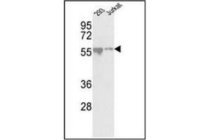 Western blot analysis of CDKL2 antibody (Center) in 293, Jurkat cell line lysates (35ug/lane). (CDKL2 antibody  (AA 233-263))