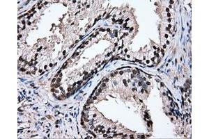 Immunohistochemical staining of paraffin-embedded prostate tissue using anti-TIPRLmouse monoclonal antibody. (TIPRL antibody)