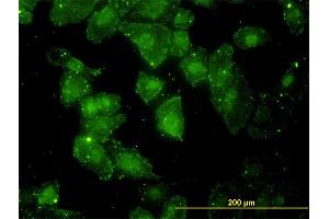 Immunofluorescence of monoclonal antibody to GCLC on HeLa cell. (GCLC antibody  (AA 528-637))