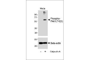 Western blot analysis of lysates from Hela cell line, untreated or treated with EGF(1 μg/mL, 10 min), using Phospho-K1 Antibody (upper) or Beta-actin (lower). (PAK1 antibody  (pThr423))