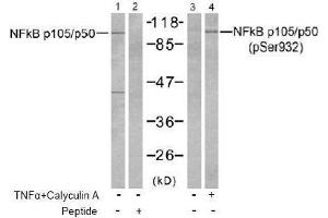 Image no. 2 for anti-Nuclear Factor of kappa Light Polypeptide Gene Enhancer in B-Cells 1 (NFKB1) (pSer932) antibody (ABIN197008) (NFKB1 antibody  (pSer932))