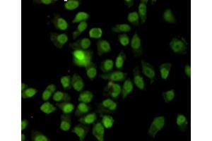 Immunocytochemistry staining of HeLa cells fixed with -20 °C Methanol and using anti-Ku70 antibody (dilution 1:200). (XRCC6 antibody)