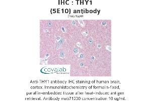 Image no. 2 for anti-CD90 (THY1) antibody (ABIN1724058)