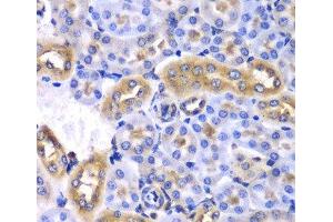 Immunohistochemistry of paraffin-embedded Mouse kidney using SYNCRIP Polyclonal Antibody at dilution of 1:100 (40x lens). (SYNCRIP antibody)