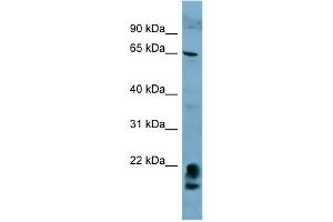 WB Suggested Anti-FAM134A Antibody Titration:  0.