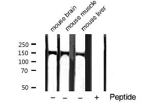 Western blot analysis of extracts of various tissue sample,using Phospho-PLCG1 (Tyr771) Antibody. (Phospholipase C gamma 1 antibody  (pTyr771))