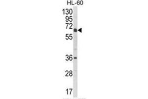 Western blot analysis of CYP2C18 Antibody (C-term) in HL-60 cell line lysates (35ug/lane). (CYP2C18 antibody  (C-Term))